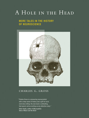 cover image of A Hole in the Head